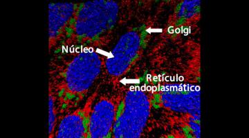 Distribución de Golgi-RE-Núcleo en 3D - Biología Celular y Molecular